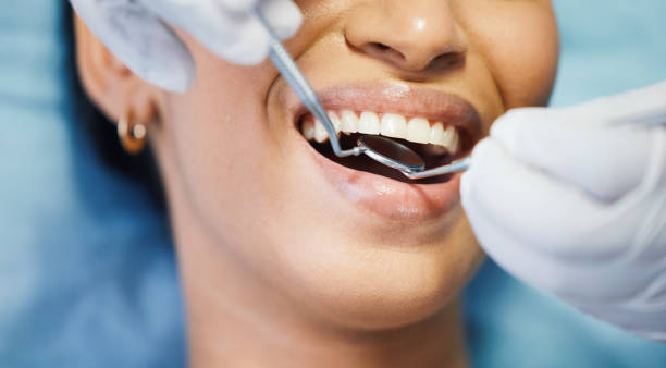 Best Emergency Dental Extractions in Rockcreek, OR