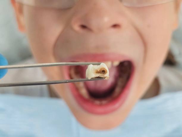Best Weekend Emergency Dentist in Rockcreek, OR