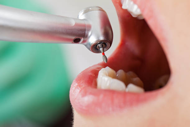 Best Mobile Emergency Dentist in Rockcreek, OR